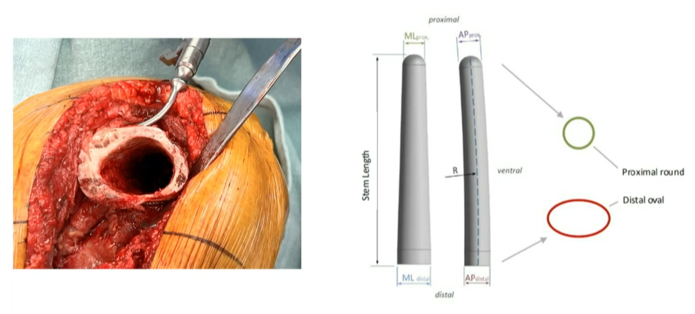 A close-up of a model of a human body AI-generated content may be incorrect.