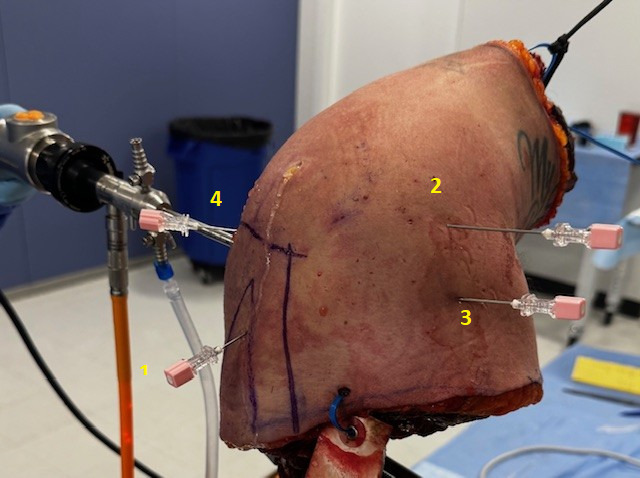 A close-up of a human body AI-generated content may be incorrect.