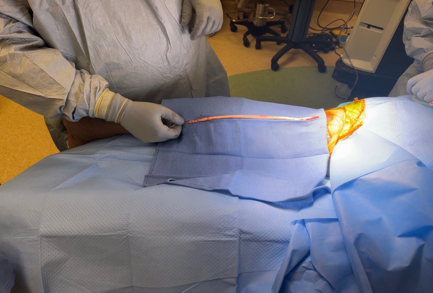 A person wearing surgical gown and gloves Description automatically generated