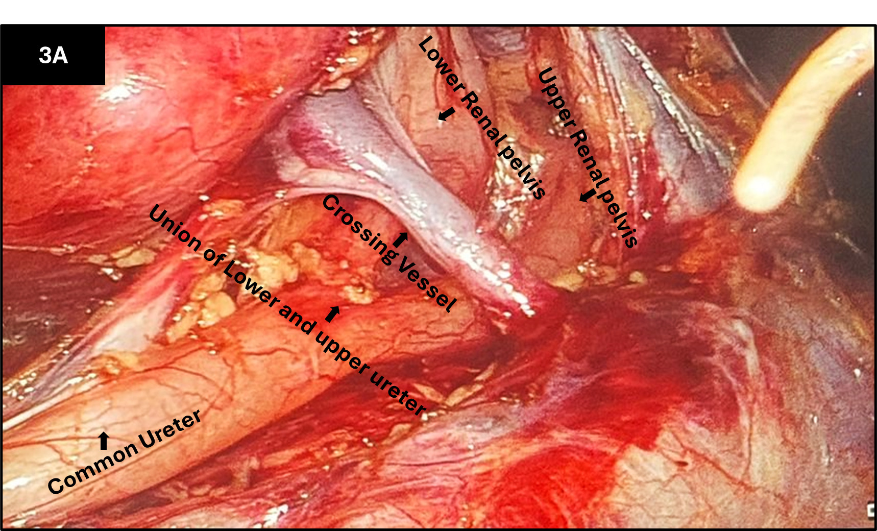 Figure 3a