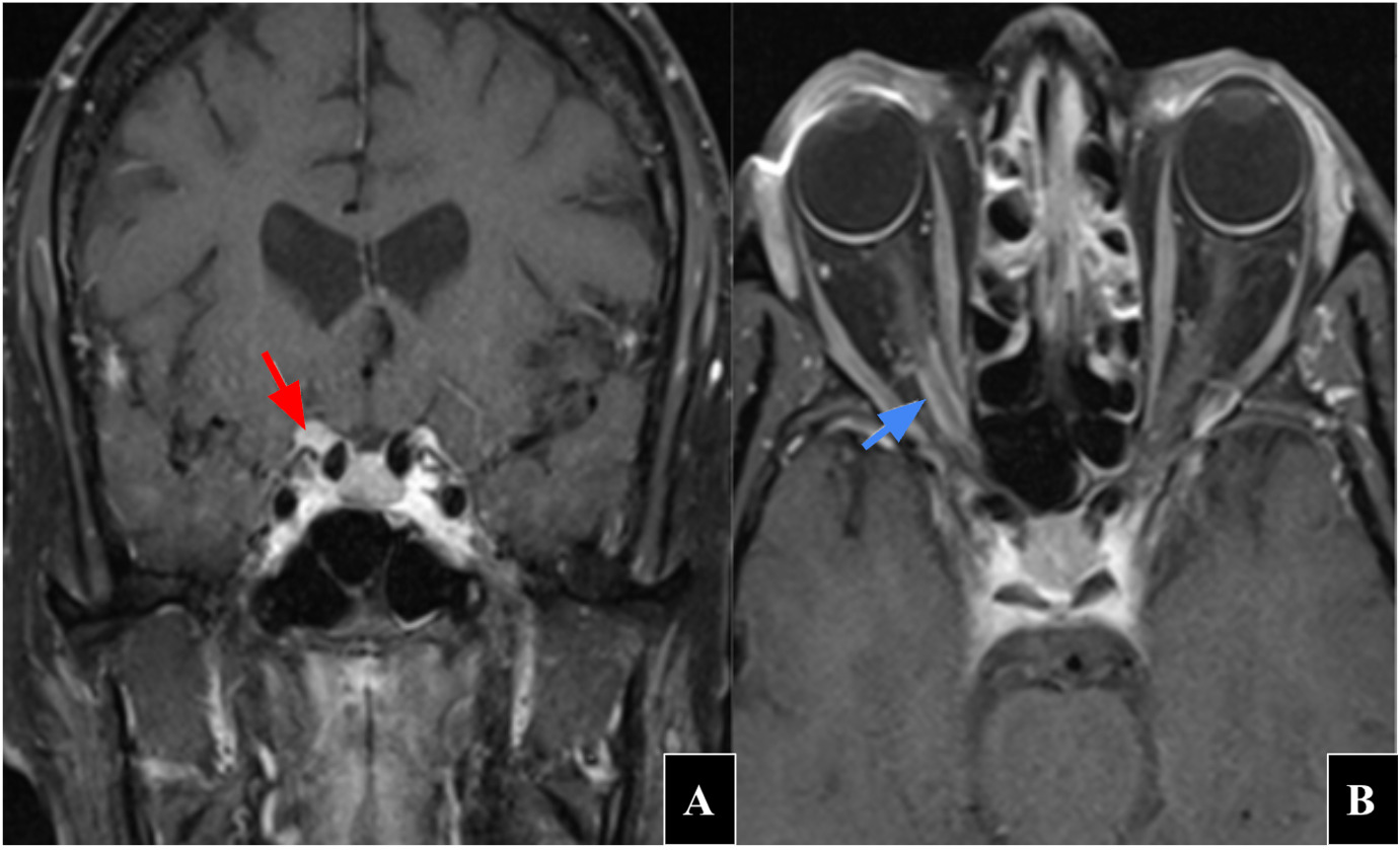A close-up of a mri scan AI-generated content may be incorrect.