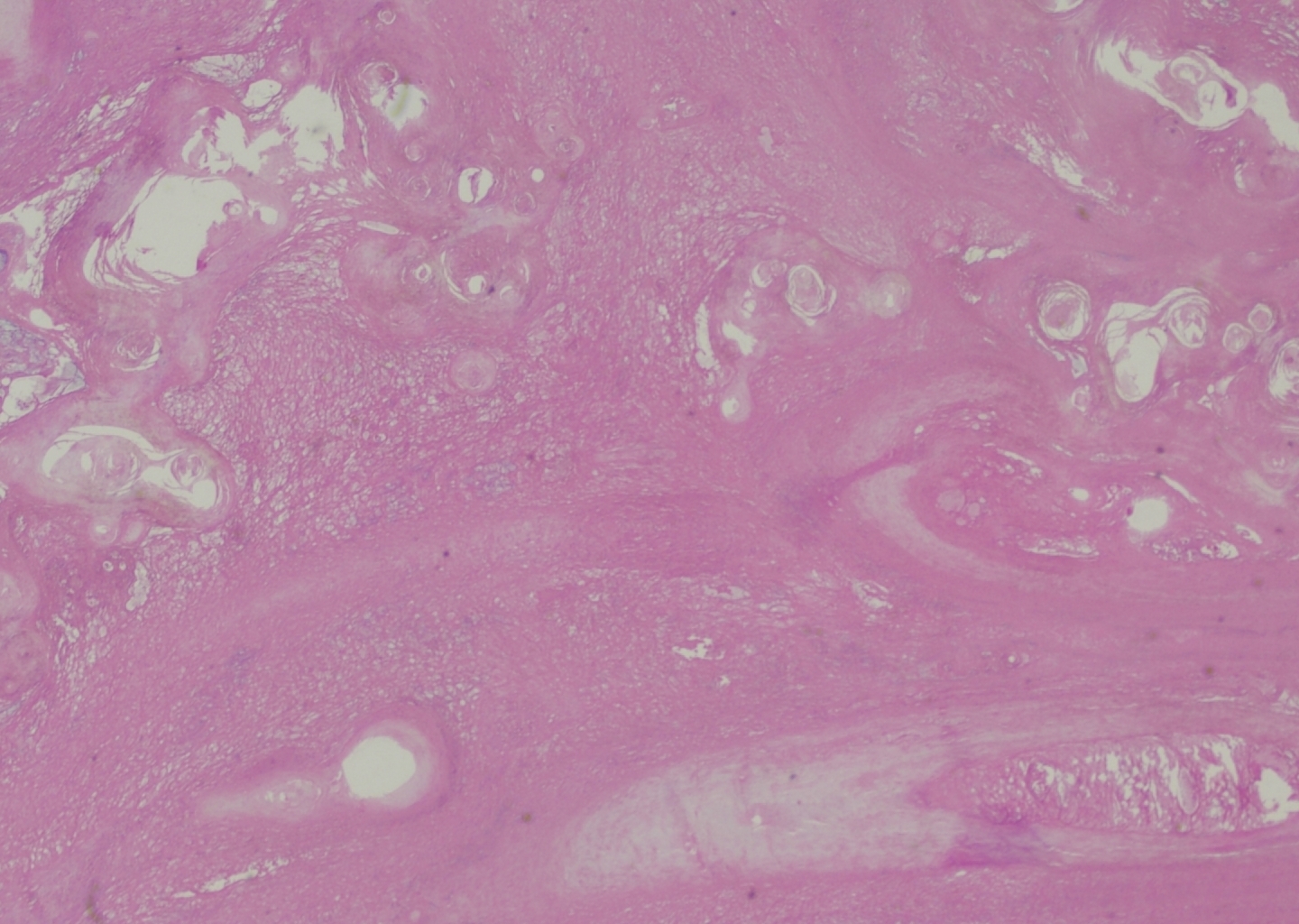 C:Usersrm19229Desktopresearchcase reporthorn x2.jpg