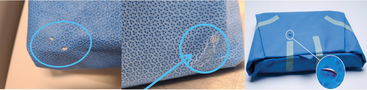 Smart Sterilization Container Technology: Blue Wrap Innovation ...