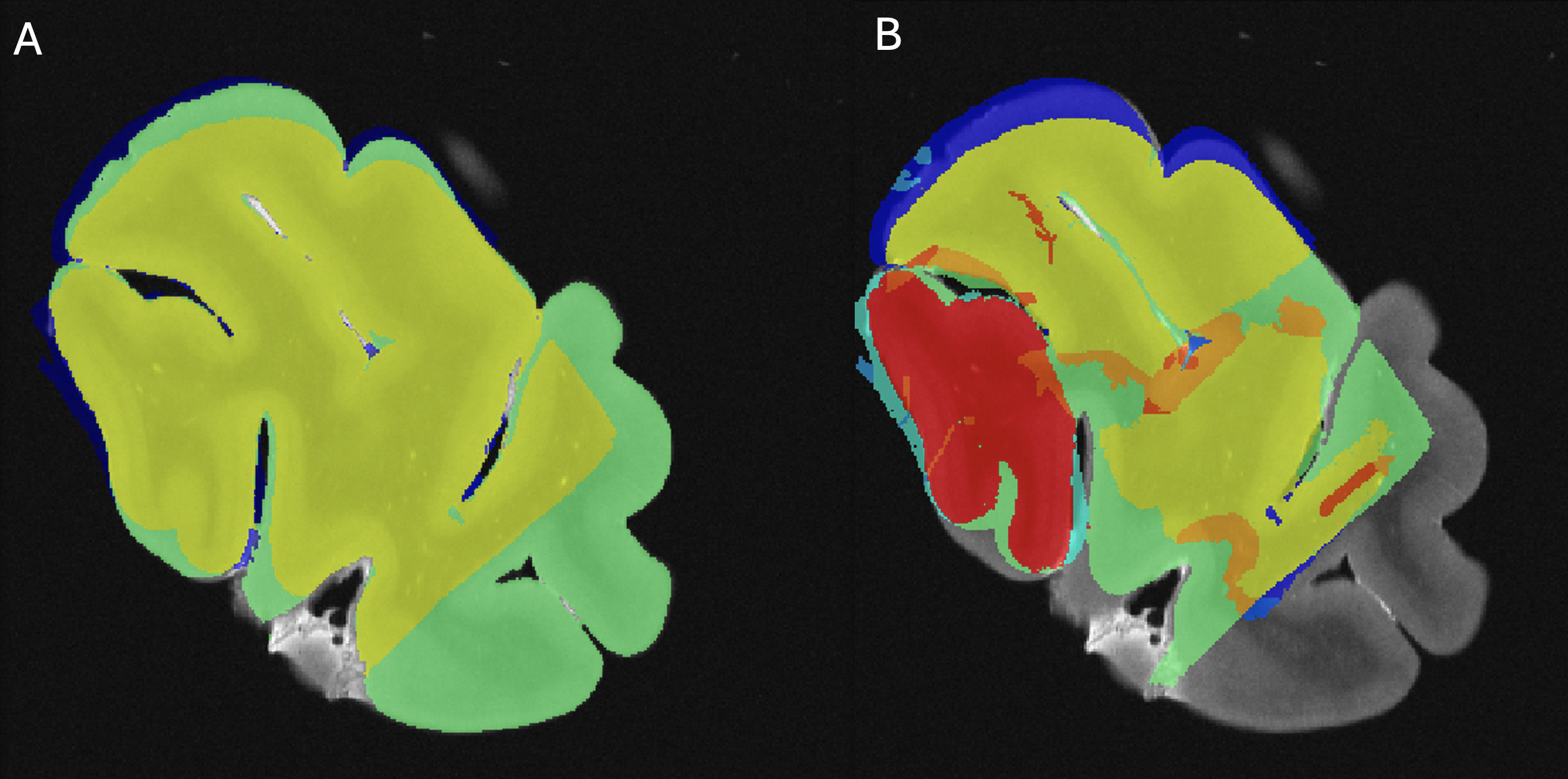 A close-up of a brain AI-generated content may be incorrect.