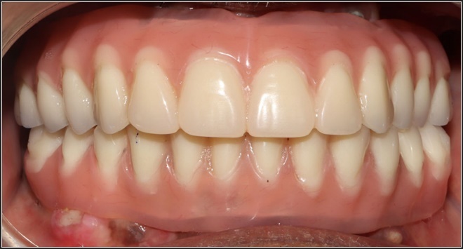 Close-up of a human teeth Description automatically generated
