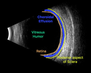 A close-up of an ultrasound AI-generated content may be incorrect.