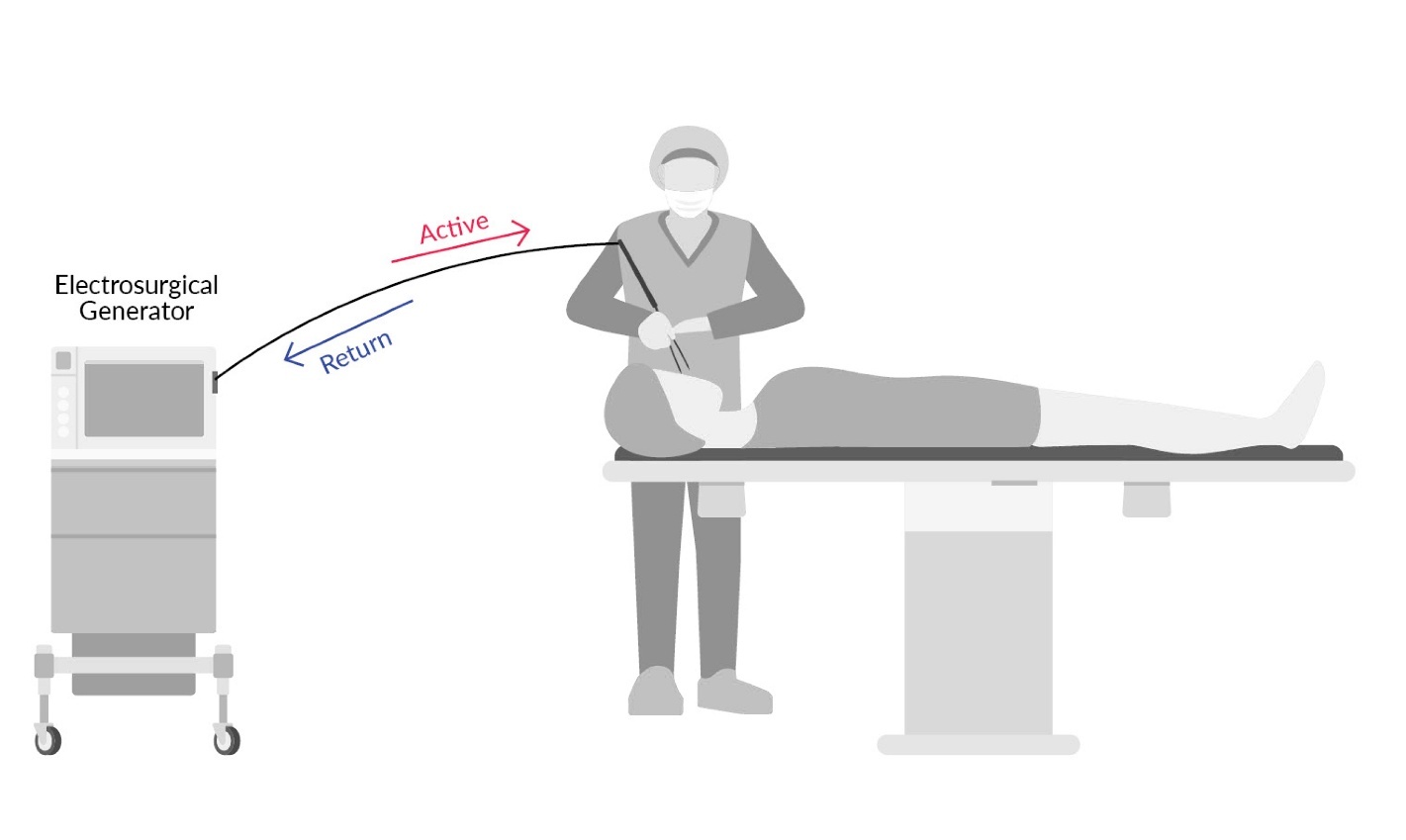 Figure 2. Illustration of Bipolar Electrosurgery.