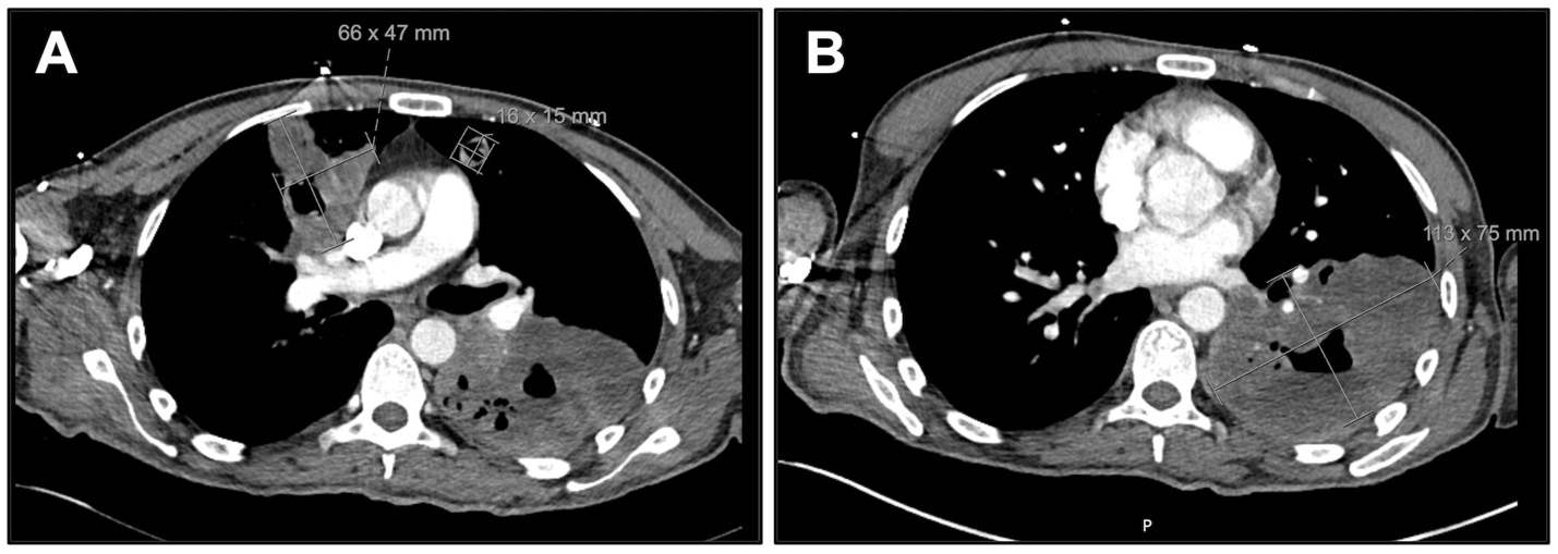 A close-up of a ct scan AI-generated content may be incorrect.