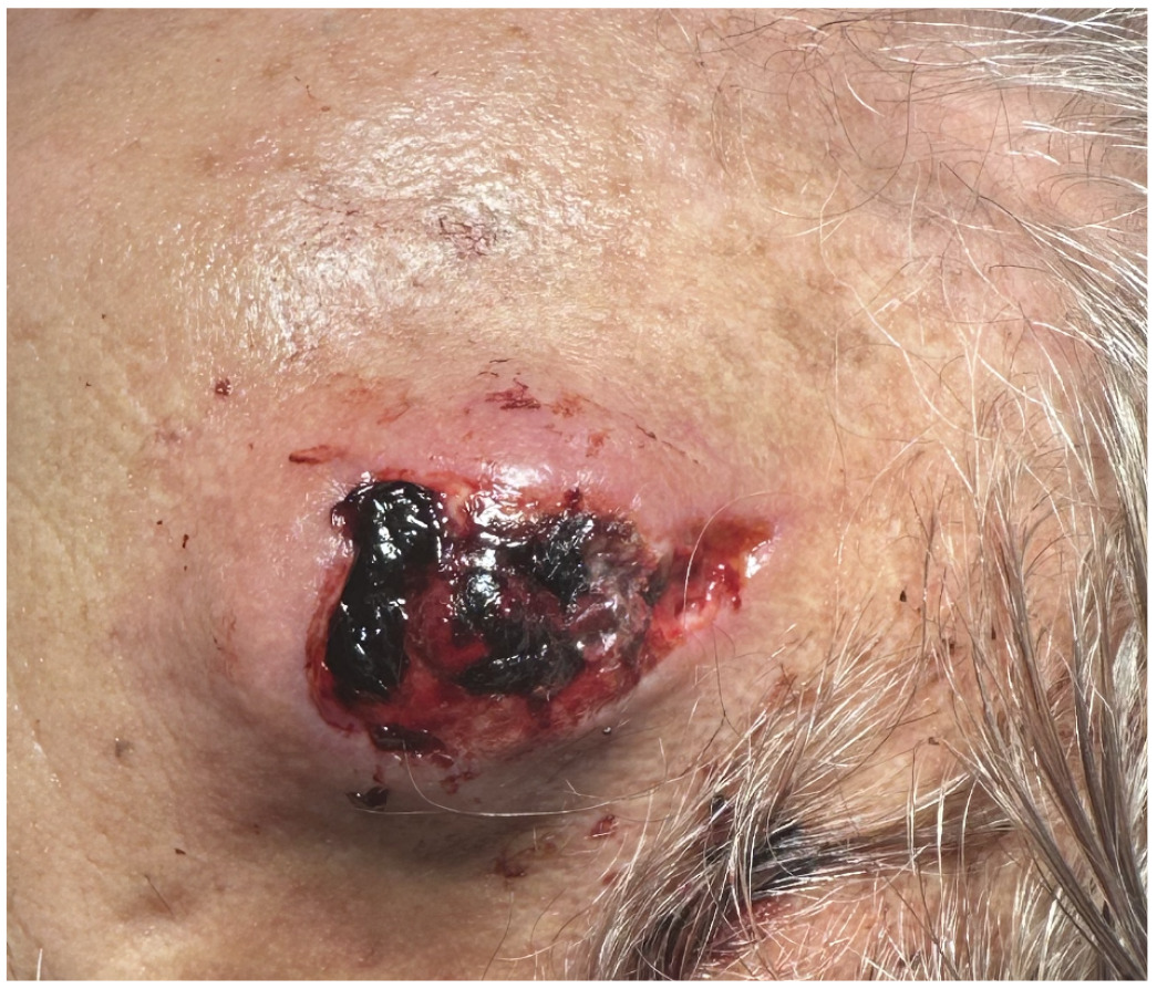 A person with a wound on his face Description automatically generated