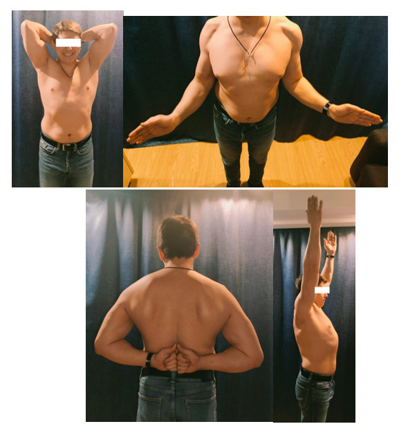 Figure 17