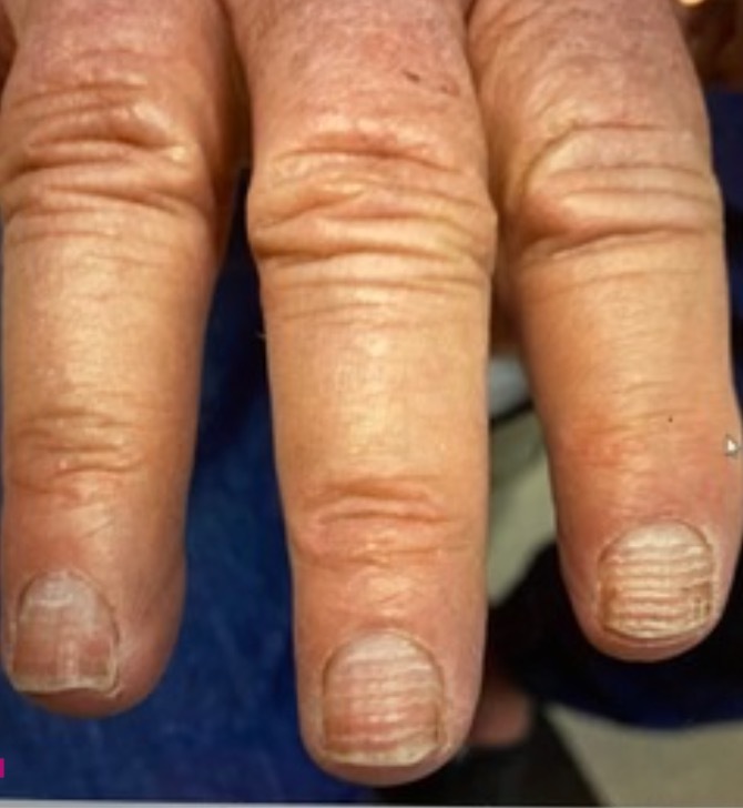 Close up of a person's fingers Description automatically generated