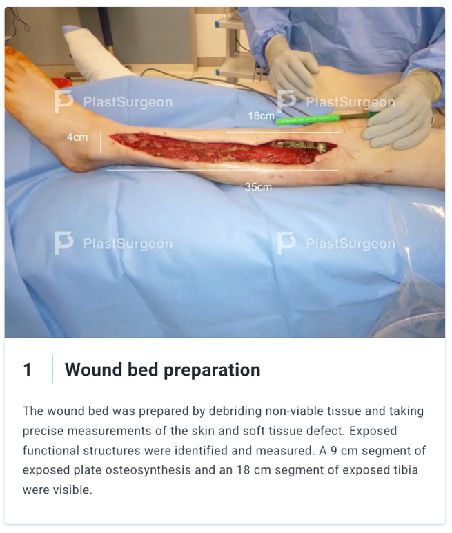 Et billede, der indeholder tekst, lægeundersøgelse/medicin, Medicinsk udstyr, sundhedsvæsen Automatisk genereret beskrivelse