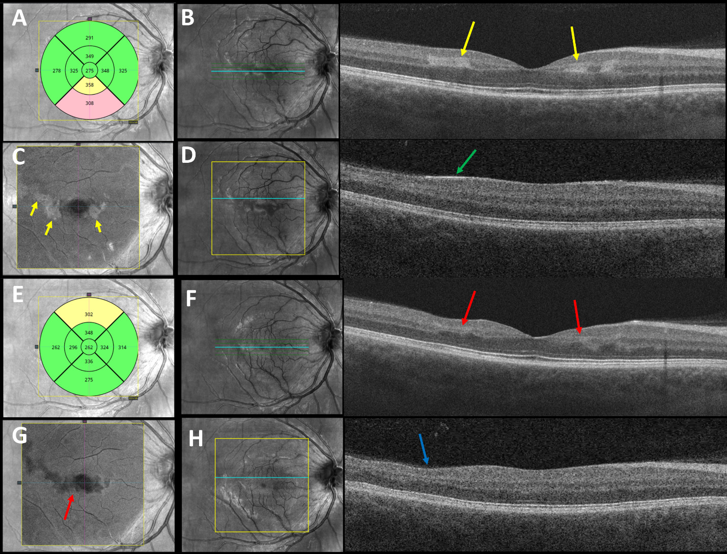 A screenshot of a video game AI-generated content may be incorrect.
