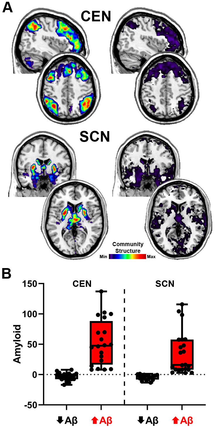 A close-up of a brain scan AI-generated content may be incorrect.