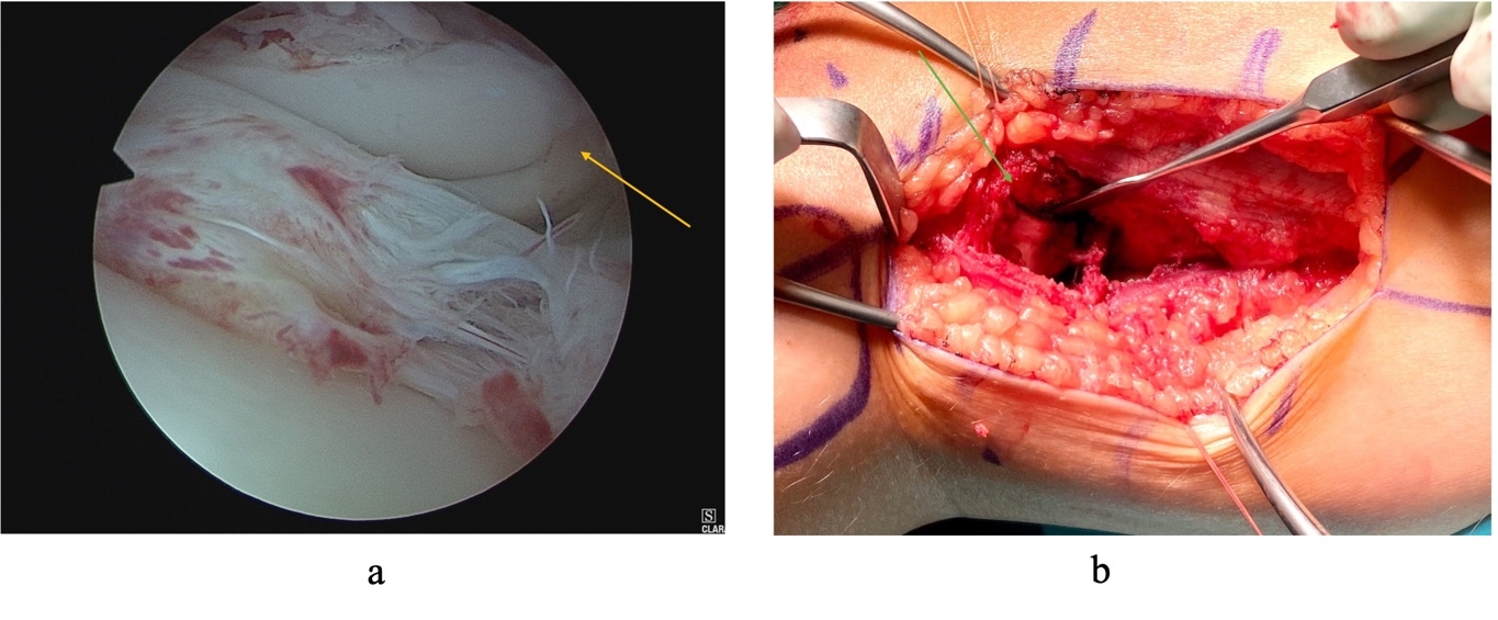 Afbeelding met Medische apparatuur, medisch, gezondheidszorg, overdekt Door AI gegenereerde inhoud is mogelijk onjuist.