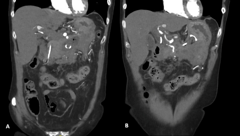 A close-up of an x-ray of a person's body AI-generated content may be incorrect.