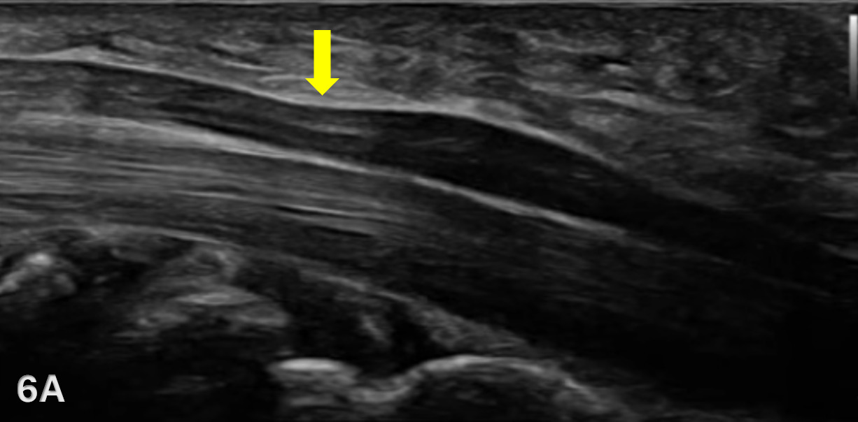 Figure 6A
