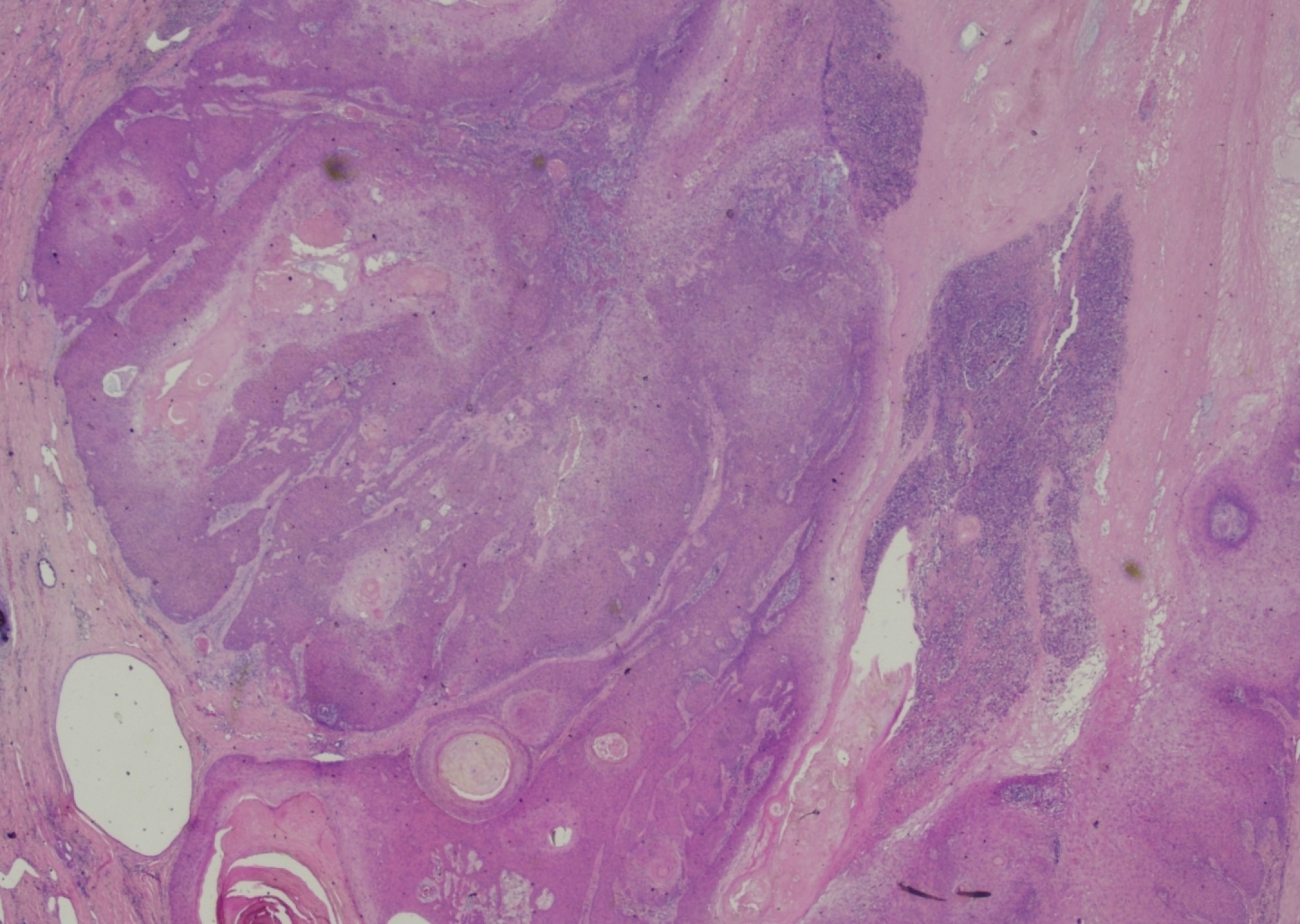 C:Usersrm19229Desktopresearchcase reporthorn.jpg