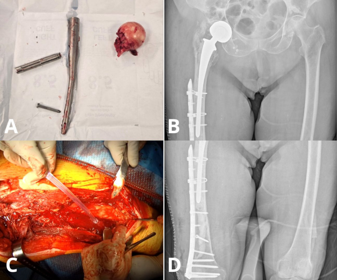 Close-up of x-ray images AI-generated content may be incorrect.