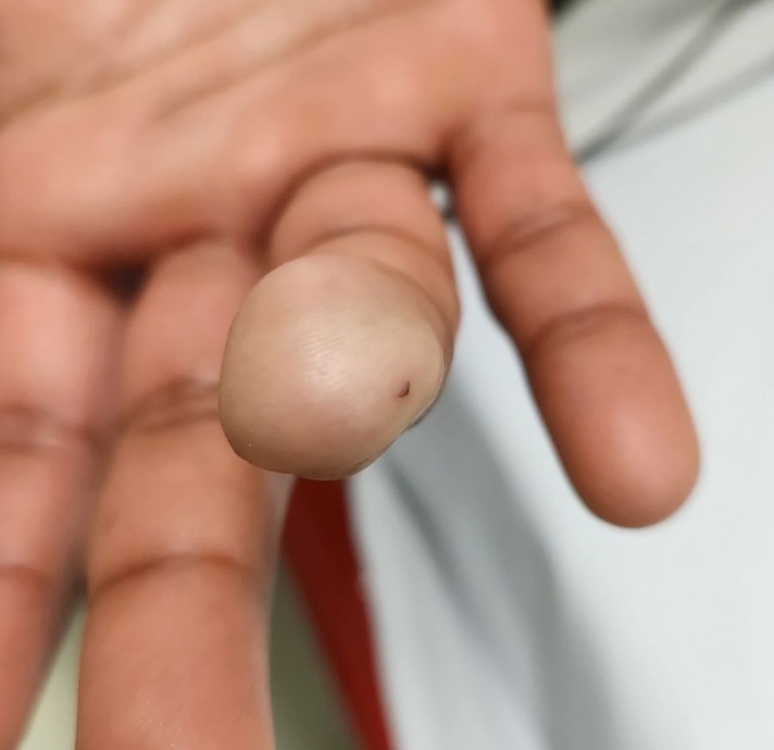 Fig 1