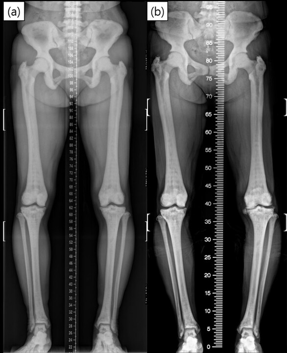 大腿骨近位部骨折 Osteosynthesis & Arthroplasty 71K42eHMAiL._UF350,350_QL50_.jpg