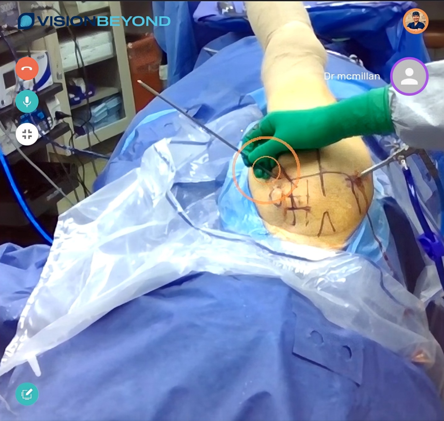 A person performing surgery on a patient AI-generated content may be incorrect.