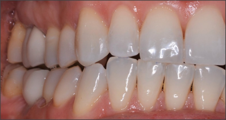 Figure 20