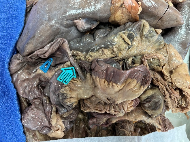 A pile of brown and green organs AI-generated content may be incorrect.