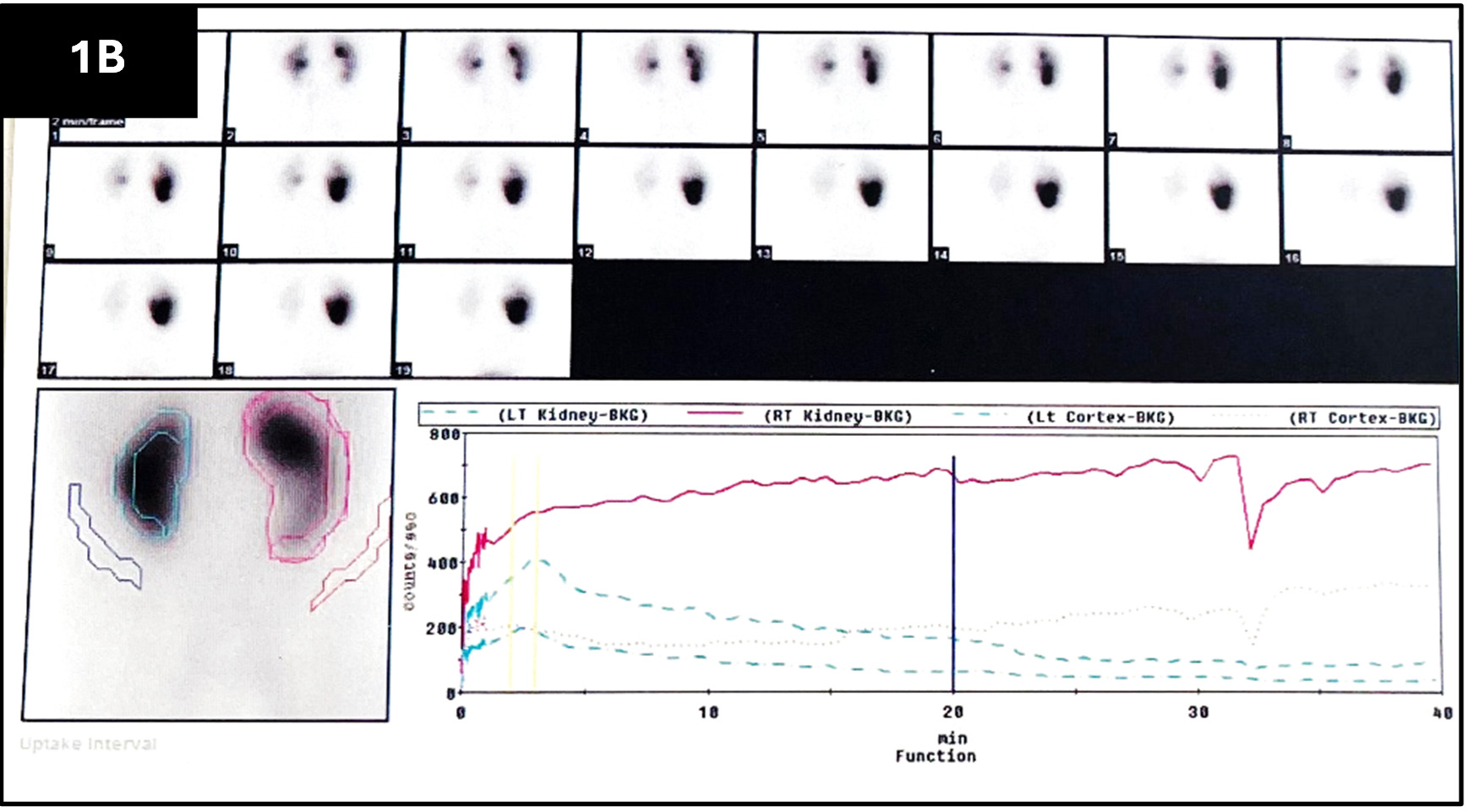 Figure 1b