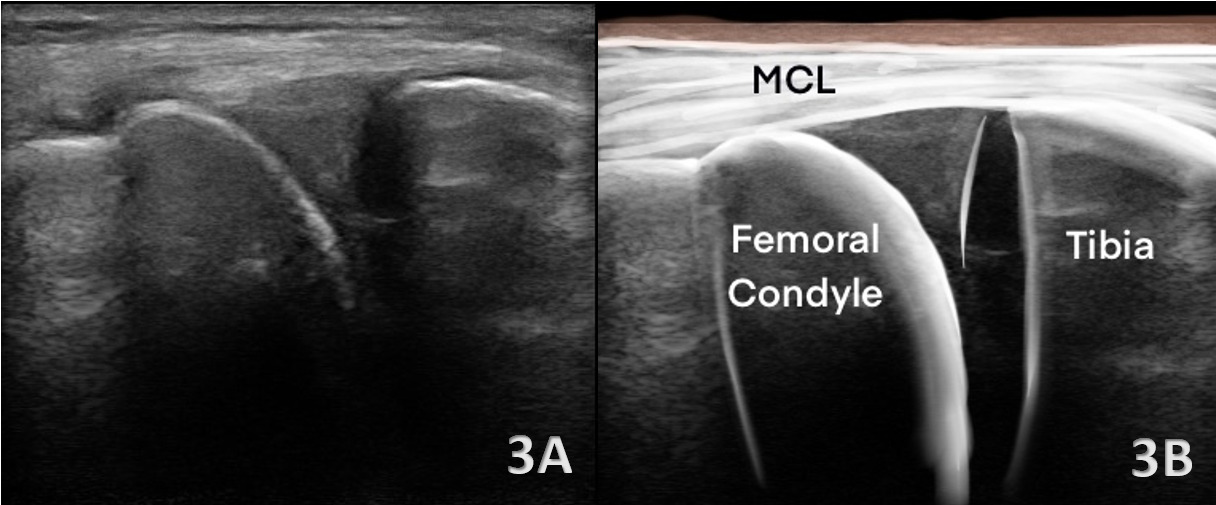 A close-up of a medical scan AI-generated content may be incorrect.