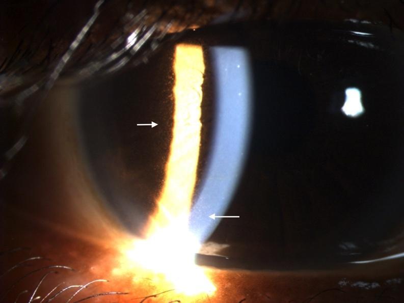 Close-up of an eye Description automatically generated