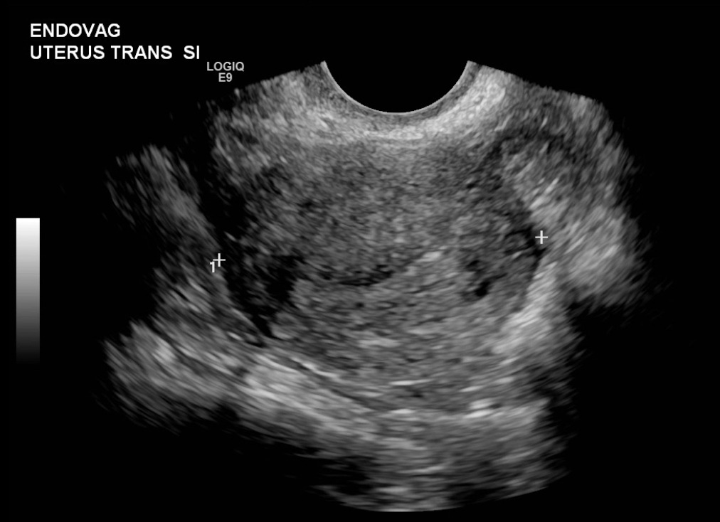 Figure 1A