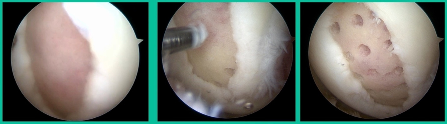 A close-up of a dog's mouth AI-generated content may be incorrect.