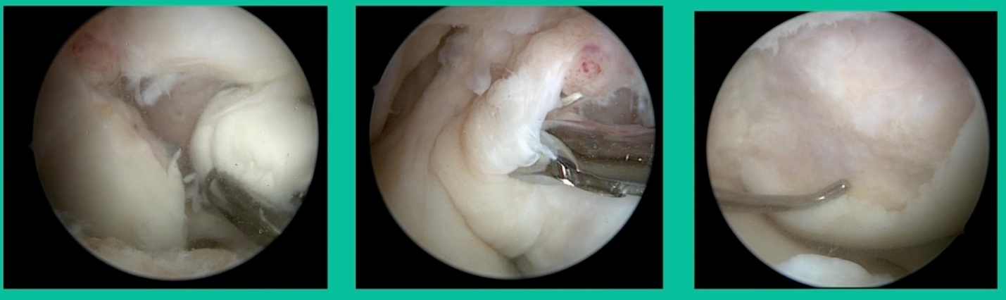 Close up of a white animal AI-generated content may be incorrect.