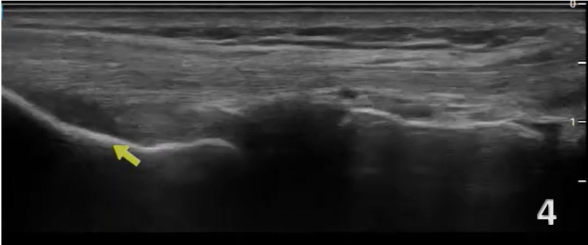 A close-up of a grey sky AI-generated content may be incorrect.