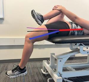 Reliability of Goniometric Techniques for Measuring Hip Flexor Length ...