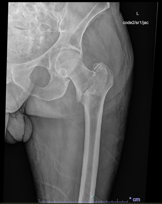 X-ray of a human body AI-generated content may be incorrect.
