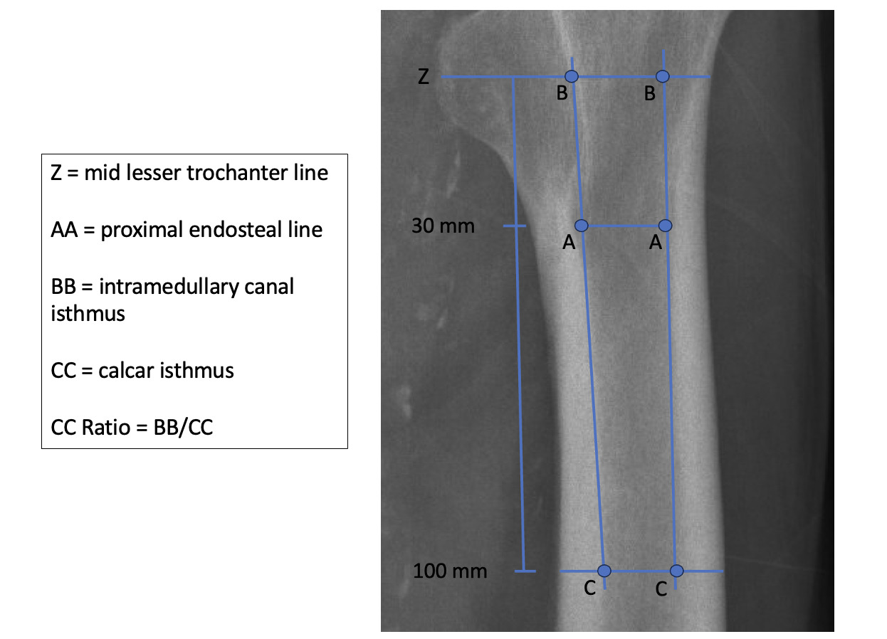 X-ray of a bone with blue lines Description automatically generated