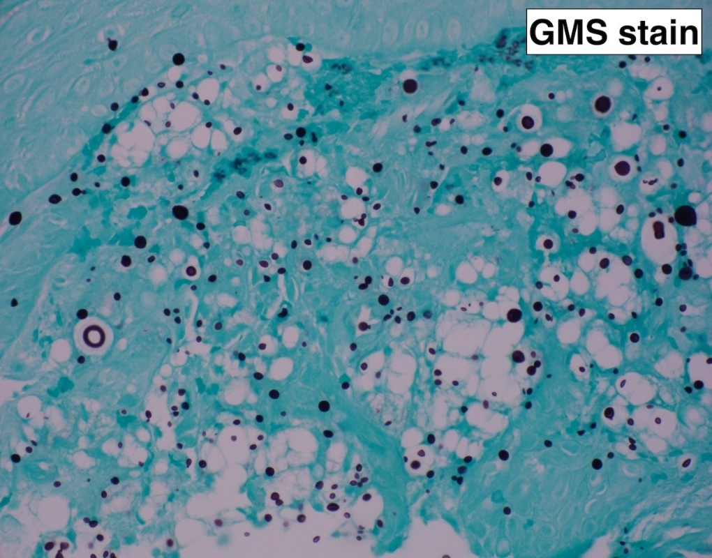 A close-up of a cell AI-generated content may be incorrect.