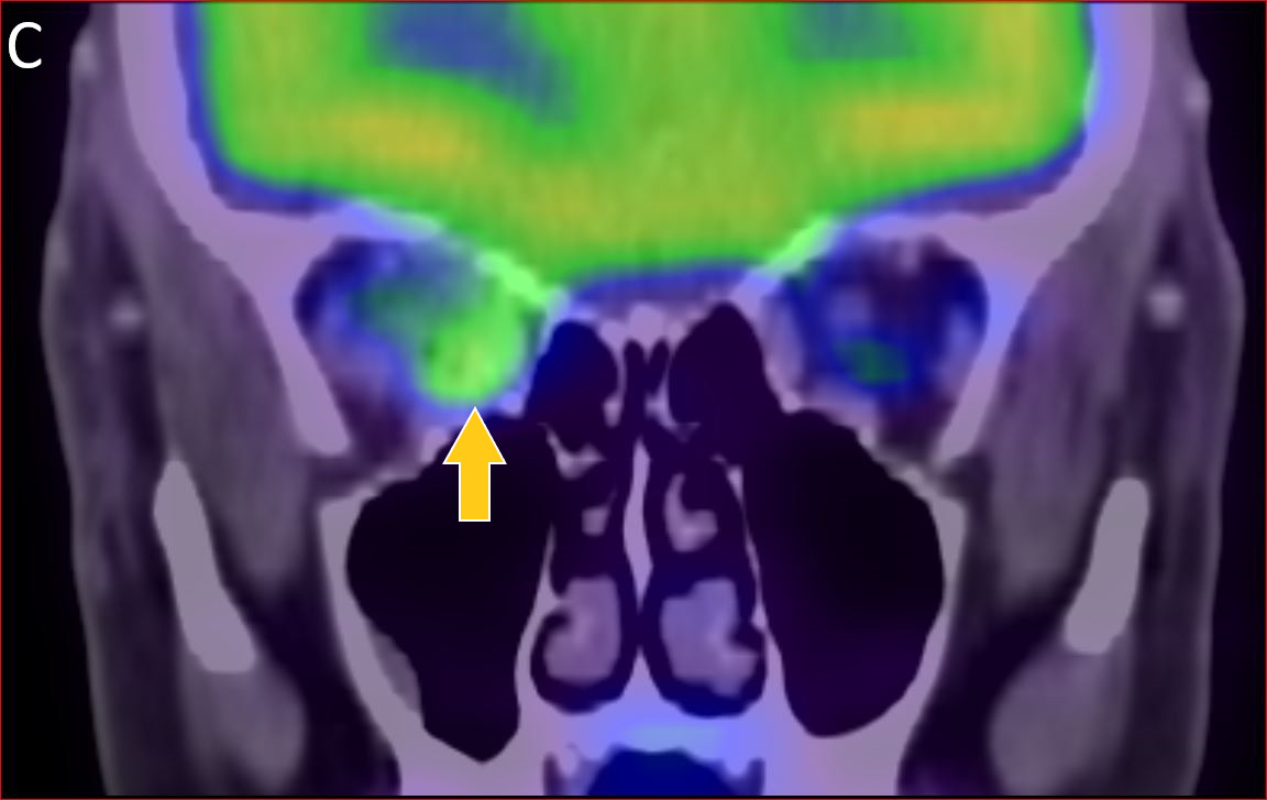 Figure C