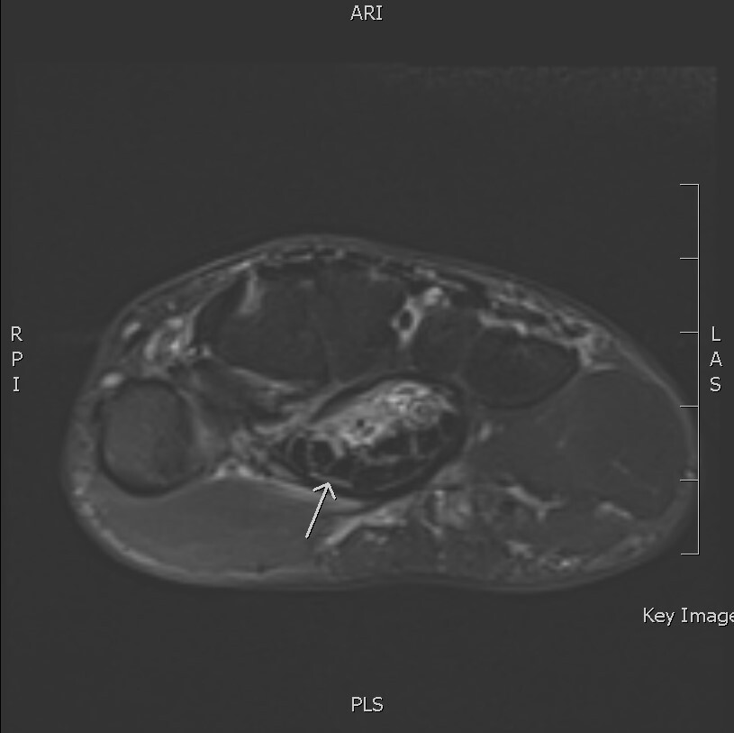 Fig 2