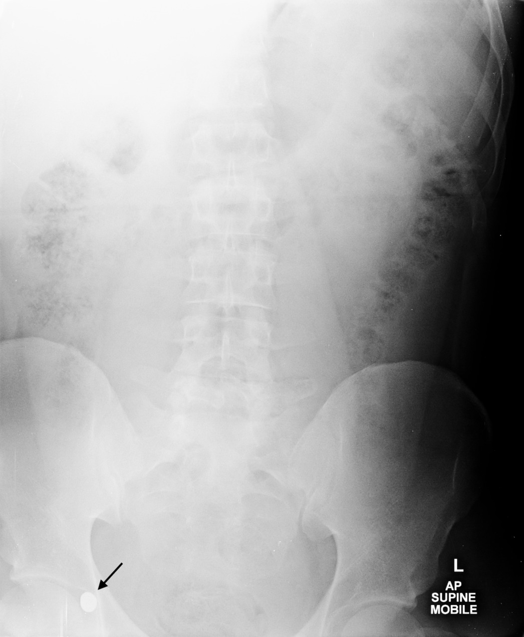 X-ray of a person's spine Description automatically generated