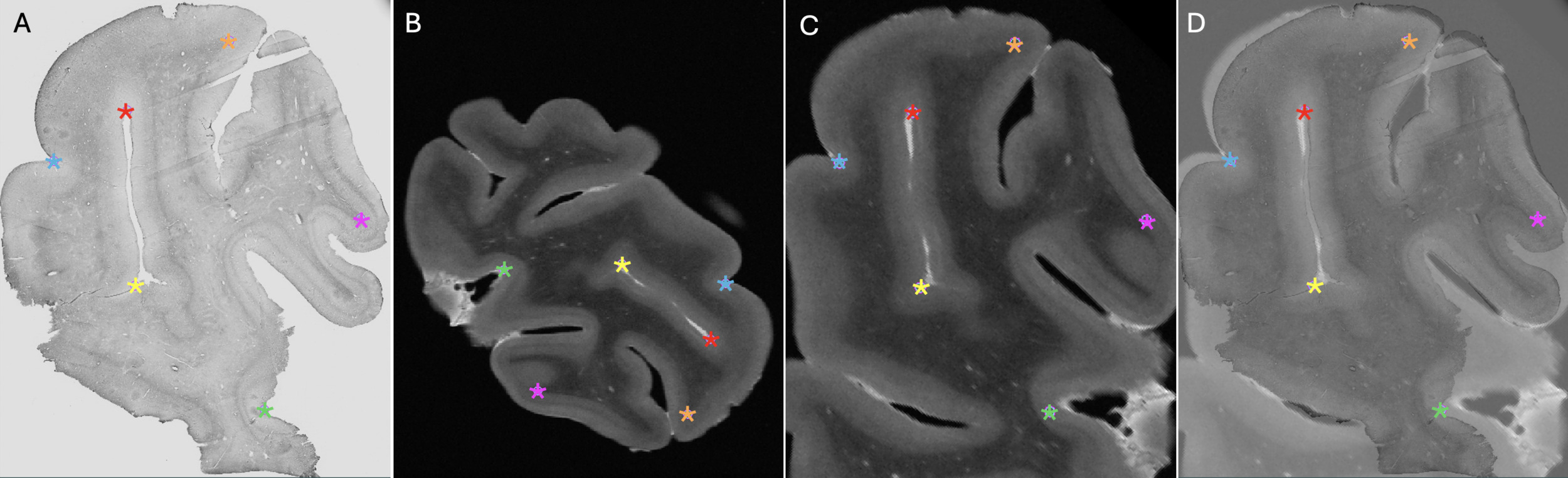 A close-up of a brain AI-generated content may be incorrect.