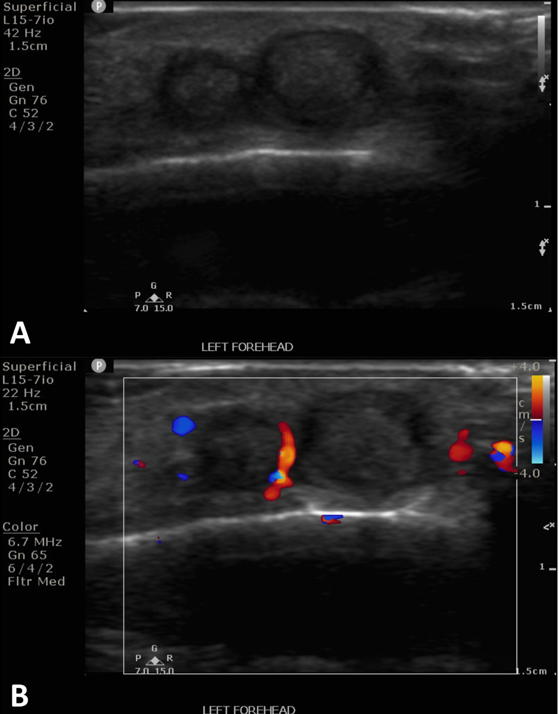A screenshot of a medical scan AI-generated content may be incorrect.