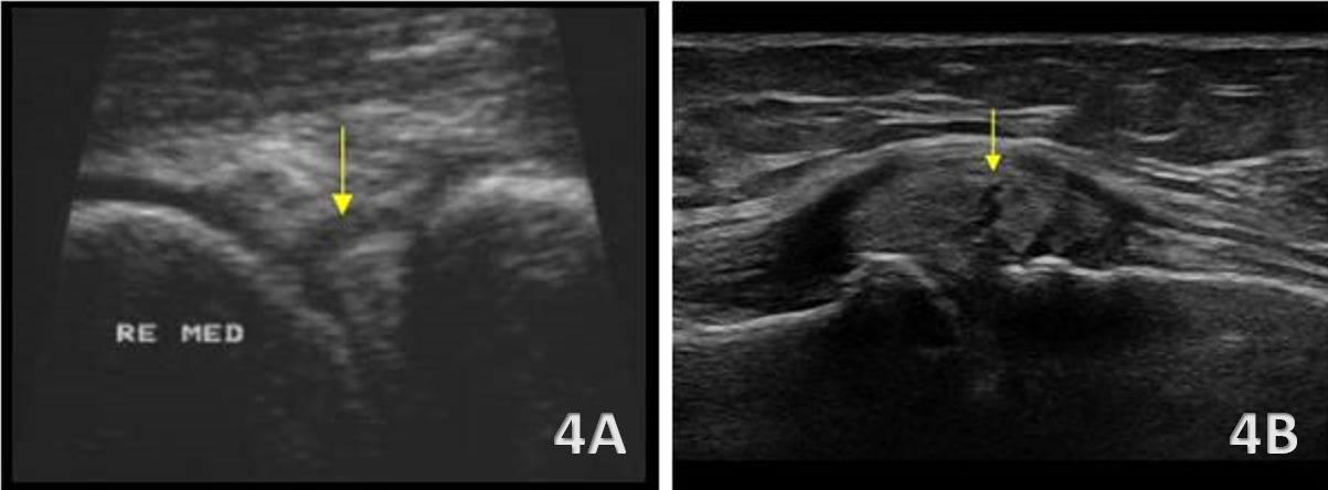 A close-up of ultrasound images AI-generated content may be incorrect.