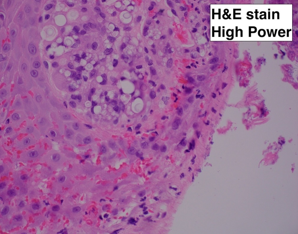 A microscope view of a pink and purple cell AI-generated content may be incorrect.