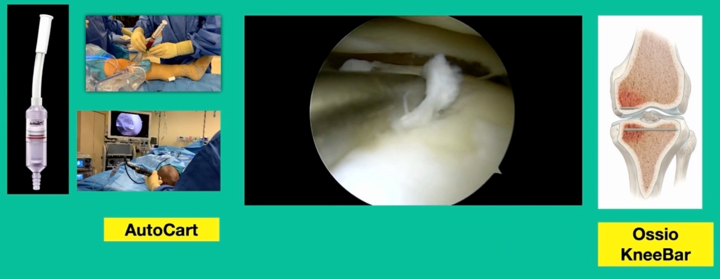 A close-up of a tooth AI-generated content may be incorrect.