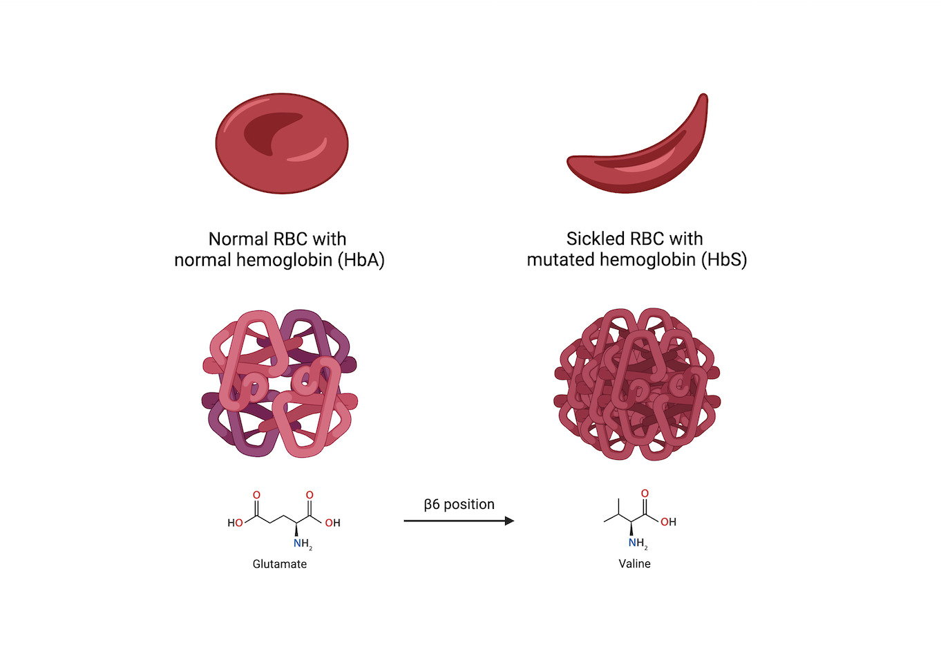 Hemoglobin Inside Rbc Sickle Cell Anemia Treatment and Advancement Toward Cure Through Stem ...