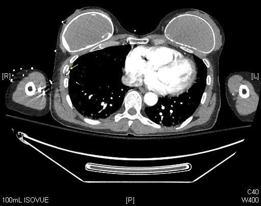 A close-up of an x-ray Description automatically generated
