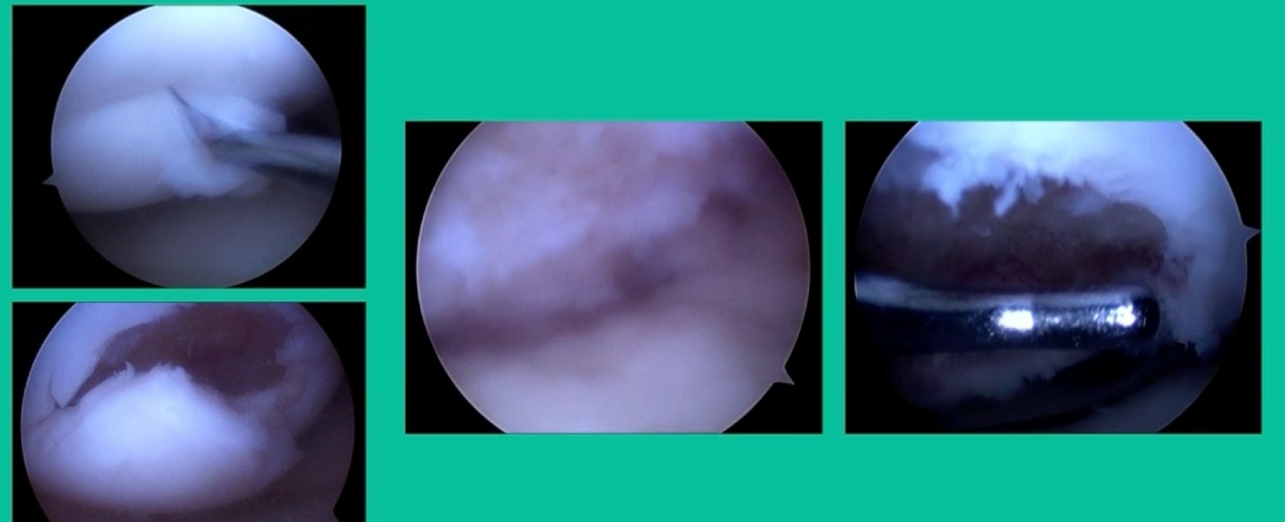 A close-up of a blue circle AI-generated content may be incorrect.